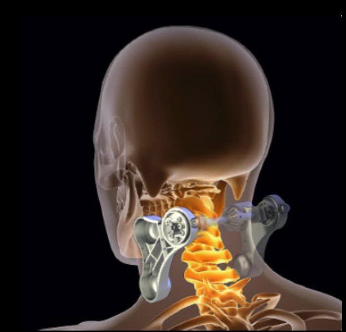 ELEEELS R5 NECK CARE MASSAGER HOT COMPRESS, CLAMPING MECHANISM