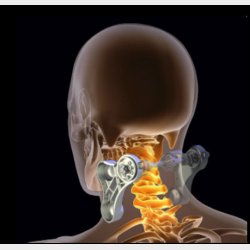 ELEEELS R5 NECK CARE MASSAGER HOT COMPRESS, CLAMPING MECHANISM